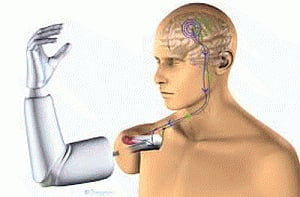 Indian-origin man develops thought-controlled prostheses