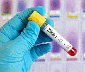 Zika virus may be transmitted through saliva, urine