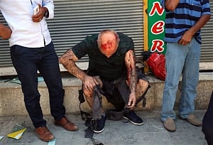 4 dead, 20 wounded in Istanbul suicide attack: Governor