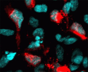 Zika virus induces cell death in human neural cells: Study