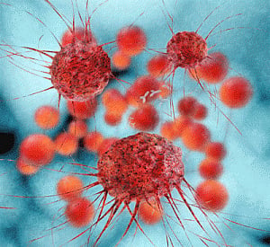 Cholesterol-lowering drug can kill prostate cancer cells