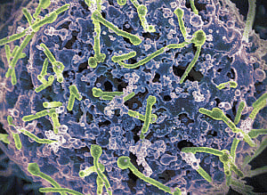 Ebola virus can persist in semen 9 months after recovery