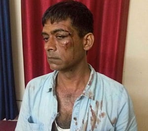 Cabbie assaulted by Africans in Delhi