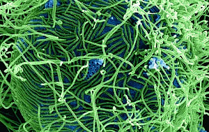 Sexual transmission could reignite contained Ebola outbreaks
