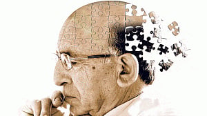 Decreased blood flow in brain earliest sign of Alzheimer's