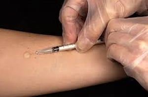 New mechanism of TB infection identified