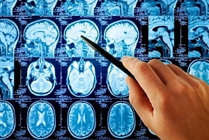 Researchers identify protein that boosts memory