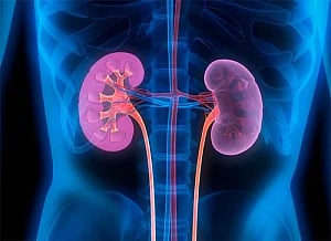 Chronic kidney disease may lead to diabetes