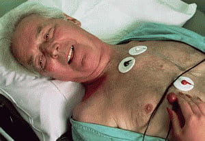 Gallstone disease may increase heart disease risk