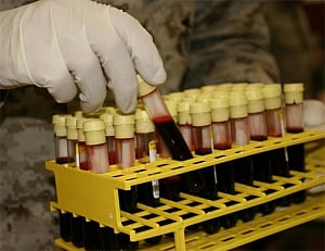 Why cholera is more deadly for people with type O blood