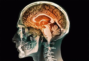 New technique manipulates brain activity to boost confidence