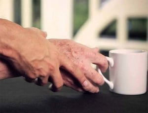A single protein may help treat Parkinson's, Alzheimer's