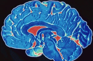 Childhood brain tumour can affect survivor's sex life later