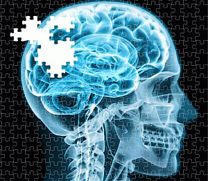 How defective brain cells are spreading Alzheimer's