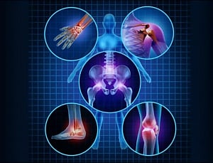 CRISPR gene editing tool to help fight arthritis