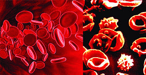 Docyard: Drawing blood
