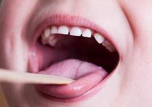 Bacteria in throat may indicate joint infection risk in kids