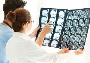 Excessive brain cell growth after head injury bad for brain