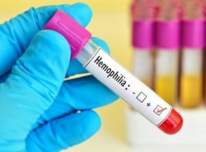 Gene therapy drug shows promise of haemophilia cure