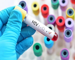 'HIV counselling, test centres in Delhi lack privacy'