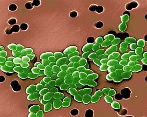 'New antibiotic to combat drug-resistant TB found in soil'