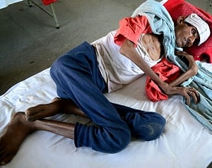 10 mn people developed TB in '17; India accounts for 27%: WHO