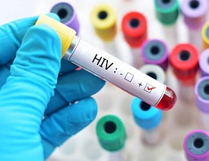 New HIV drug effectively reduces virus, boosts immunity: Study