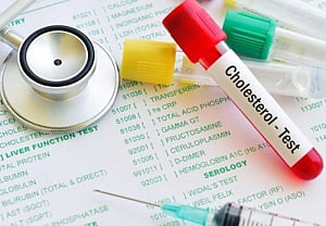 Excessive 'good' cholesterol can be life threatening: Study