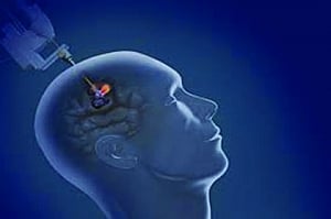 Dockyard | Neurosurgery gets hi-tech