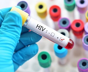 HIV diagnoses in Australia dips by 7%: Study