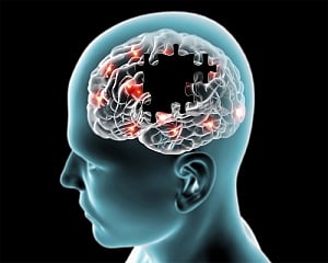 New AI tool can predict Alzheimer's risk