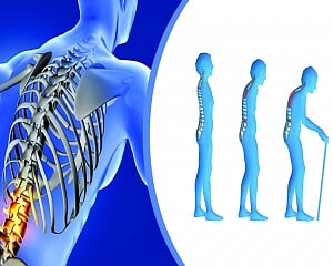 Take care of your Bones