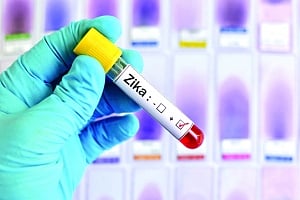 Zika imperils tourism in India’s golden triangle
