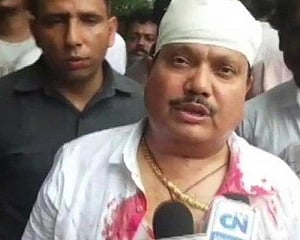 BJP MP suffers head injuries during clash, claims cops baton Charged him