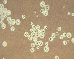 Copycat fungus deactivates body's response to infection