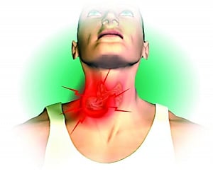 Dockyard | Throat cancer has high survival rate