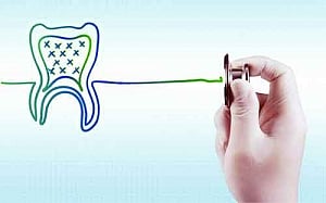 DocYard | Keep gums in tip top condition
