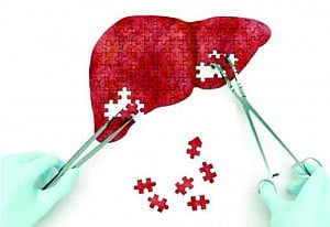 Docyard | Keep your liver healthy