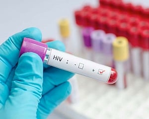 India reduced TB deaths among people living with HIV by 84 per cent : UN