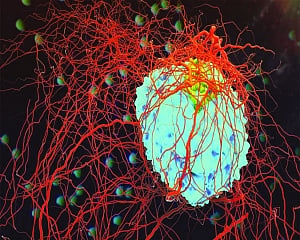 Inside India’s cancer epidemic