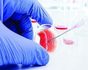 Lifestyle disorders find a solution in stem cell therapy