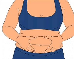 Overweight people have better chances of survival from stroke: Study