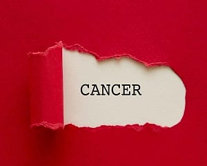 Poor oral health may up liver cancer risk