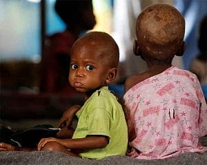 Poorest countries facing both obesity and malnutrition: Lancet study