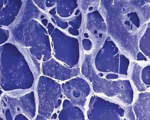 Tiny bubbles in our body to fight cancer better than chemo