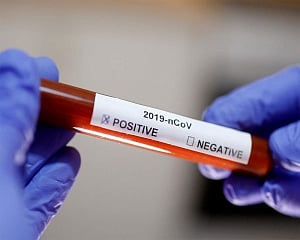 4-month old COVID-19 positive girl baby dies in Kerala