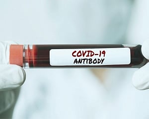 Antibodies with potential to block COVID-19 virus identified
