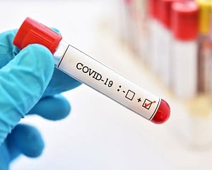 Coronavirus found in patients' semen in small Chinese study