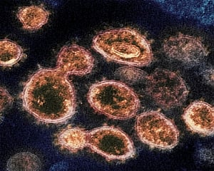 Herd immunity is dangerous and flawed approach: Lancet