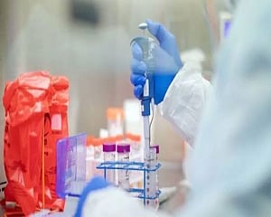 ICMR plans to study whether novel coronavirus strain in India changed form